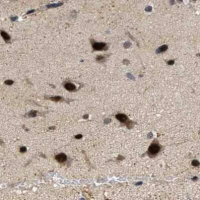 Immunohistochemistry-Paraffin: LARP6 Antibody [NBP1-89277] - Staining of human cerebral cortex shows moderate to strong nuclear positivity in neurons.