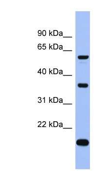 Western Blot: LARP6 Antibody [NBP1-57460] - ACHN cell lysate, concentration 0.2-1 ug/ml.