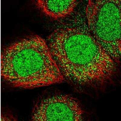 Immunocytochemistry/ Immunofluorescence LARP7 Antibody