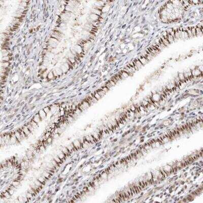 Immunohistochemistry-Paraffin LARP7 Antibody