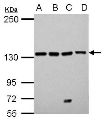 Western Blot: LARS Antibody [NBP2-19333] - Sample (30 ug of whole cell lysate) A: NT2D1 B: PC-3 C: U87-MG D: SK-N-SH 5% SDS PAGE gel, diluted at 1:1000.