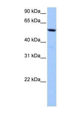 Western Blot: LAS2 Antibody [NBP1-79525] - Hela cell lysate, concentration 0.2-1 ug/ml.