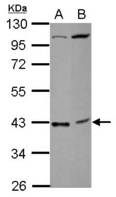 Western Blot: LAS2 Antibody [NBP2-15638] - Sample (30 ug of whole cell lysate) A: NT2D1 B: SK-N-SH 10% SDS PAGE gel, diluted at 1:1000.