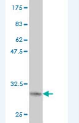 Western Blot: LASS1 Antibody (2E8) [H00010715-M01] - Detection against Immunogen (31.24 KDa) .