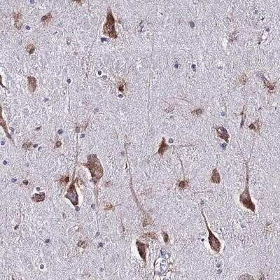 Immunohistochemistry-Paraffin LASS1 Antibody