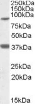 Western Blot LASS1 Antibody