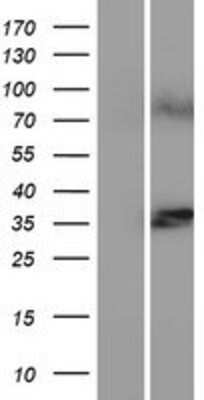 Western Blot LASS1 Overexpression Lysate