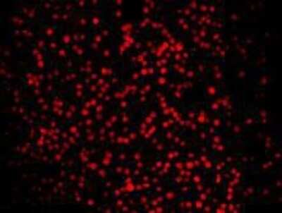 Immunocytochemistry/Immunofluorescence: LASS2 Antibody (B3-2) [NBP2-66930] - Staining LASS2 (red) in K562 cells. Cells were fixed in paraformaldehyde, permeabilised with 0.25% Triton X100/PBS.
