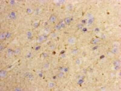 Immunohistochemistry-Paraffin: LASS2 Antibody (B3-2) [NBP2-66930] - Analysis of paraffin-embedded human brain tissue using anti-LASS2 antibody. Counter stained with hematoxylin.