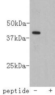 Western Blot: LASS2 Antibody (B3-2) [NBP2-66930] - Analysis on K562-AO2 cell lysate using anti-lass2 monoclonal antibody.
