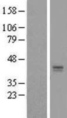 Western Blot: LASS2 Overexpression Lysate (Adult Normal) [NBP2-06475] Left-Empty vector transfected control cell lysate (HEK293 cell lysate); Right -Over-expression Lysate for LASS2.