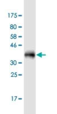 Western Blot LASS3 Antibody (6C12) - Azide and BSA Free