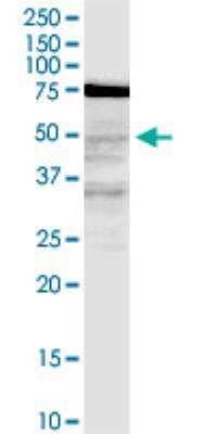 Western Blot LASS3 Antibody (6C12) - Azide and BSA Free