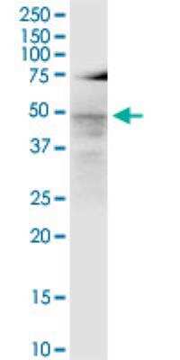 Western Blot LASS3 Antibody (6C12) - Azide and BSA Free