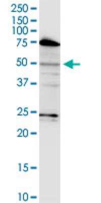 Western Blot LASS3 Antibody (6C12) - Azide and BSA Free