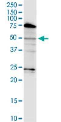Western Blot LASS3 Antibody (6C12) - Azide and BSA Free