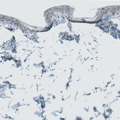 Immunohistochemistry-Paraffin LASS3 Antibody