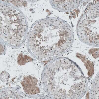 Immunohistochemistry-Paraffin LASS3 Antibody