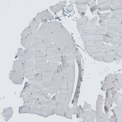 Immunohistochemistry-Paraffin LASS3 Antibody - BSA Free