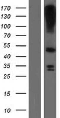Western Blot LASS3 Overexpression Lysate