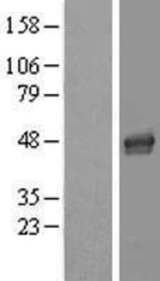 Western Blot: LASS4 Overexpression Lysate (Adult Normal) [NBL1-12443] Left-Empty vector transfected control cell lysate (HEK293 cell lysate); Right -Over-expression Lysate for LASS4.