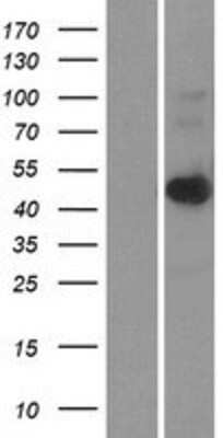 Western Blot: LASS6 Overexpression Lysate (Adult Normal) [NBP2-04549] Left-Empty vector transfected control cell lysate (HEK293 cell lysate); Right -Over-expression Lysate for LASS6.