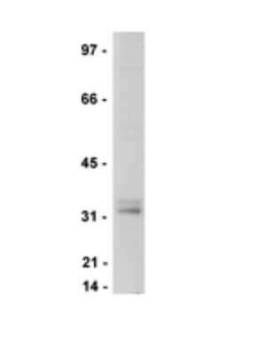 Western Blot: LAT Antibody (11B.12) [NBP2-29700] - Jurkat cell lysate was probed with anti-LAT, clone 11B.12 (1:1000).