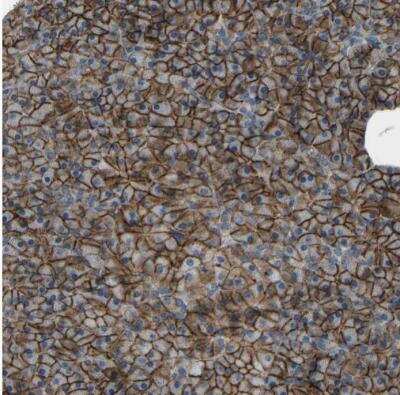 Immunohistochemistry-Paraffin LAT3 Antibody