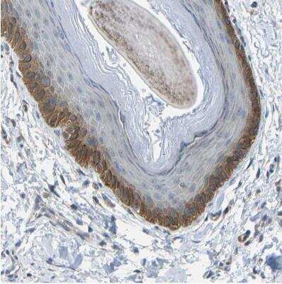 Immunohistochemistry-Paraffin LAT3 Antibody