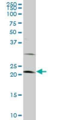 Western Blot: LATS1 Antibody (3A7) [H00009113-M09] - S1 monoclonal antibody (M09), clone 3A7. Western Blot analysis of LATS1 expression in HeLa ( Cat # L013V1 ).