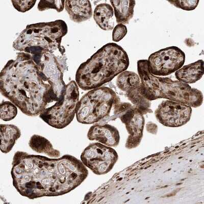 Immunohistochemistry-Paraffin: LATS1 Antibody [NBP1-86860] - Staining of human placenta shows strong cytoplasmic positivity in trophoblastic cells.