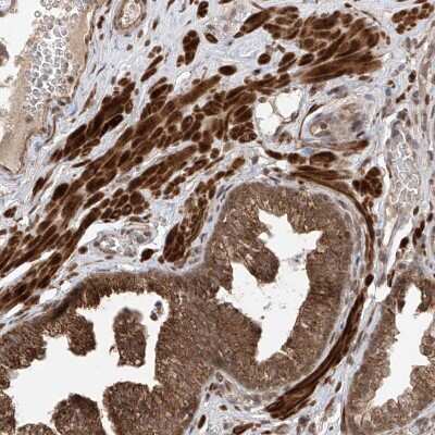 Immunohistochemistry-Paraffin: LATS1 Antibody [NBP1-86860] - Staining of human prostate shows strong cytoplasmic positivity in smooth muscles and glandular cells.