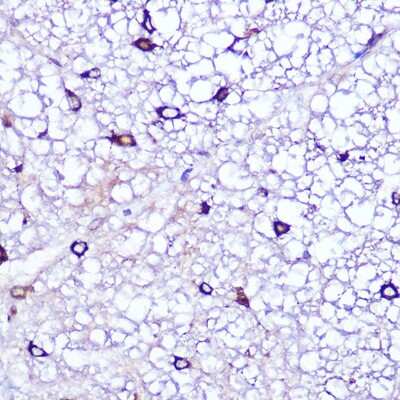 Immunohistochemistry-Paraffin: LATS1 Antibody [NBP3-05224] - Rat spinal cord using LATS1 Rabbit pAb (NBP3-05224) at dilution of 1:100 (40x lens). Perform microwave antigen retrieval with 10 mM Tris/EDTA buffer pH 9.0 before commencing with IHC staining protocol.