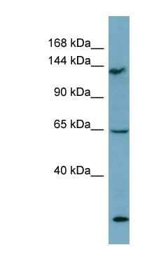 Western Blot: LATS1 Antibody [NBP1-58271] - THP-1 cell lysate, concentration 0.2-1 ug/ml.