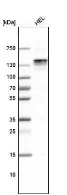 Western Blot LATS1 Antibody