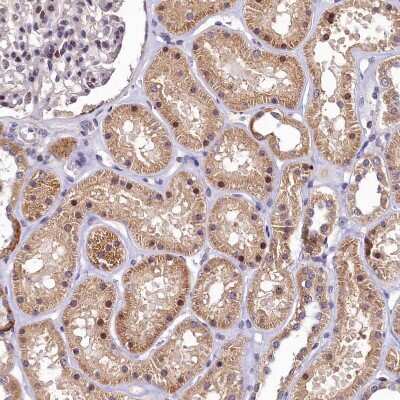 Immunohistochemistry-Paraffin LATS2 Antibody