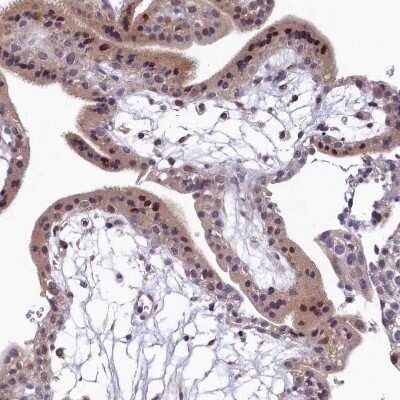 Immunohistochemistry-Paraffin LATS2 Antibody