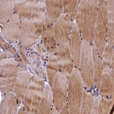 Immunohistochemistry-Paraffin LATS2 Antibody