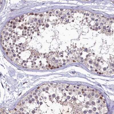 Immunohistochemistry-Paraffin LATS2 Antibody