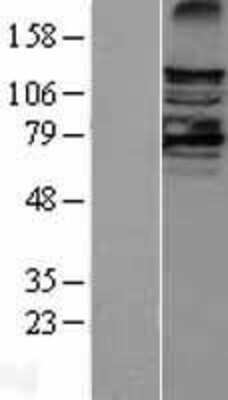 Western Blot LATS2 Overexpression Lysate