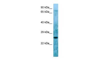 Western Blot LBHD1 Antibody - BSA Free