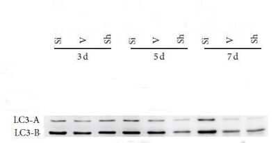 Western Blot: LC3A Antibody - Azide Free [NBP2-33254] - The expression of LC3A in rat tissue. Antibody dilution 1:1000. Image from the standard format of this antibody. WB image submitted by a verifed customer review.