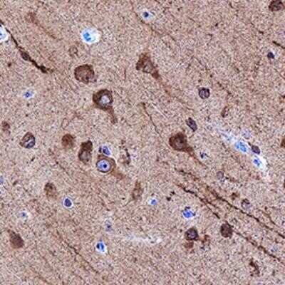 Immunohistochemistry-Paraffin: LC3A Antibody (2312D) - Azide and BSA Free [NBP2-80828] - LC3A was detected in immersion fixed paraffin-embedded sections of human brain (frontal cortex) using Rabbit Anti-Human LC3A Monoclonal Antibody (Catalog # NBP2-75924) at 3 ug/mL for 1 hour at room temperature followed by incubation with the Anti-Rabbit I