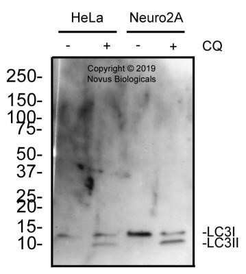 Western Blot: LC3A Antibody (2312D) - Azide and BSA Free [NBP2-80828] - This LC3A antibody image shows the total protein from human HeLa and mouse Neuro2A cells treated with and without 50 uM chloroquine for 24 hours was separated on a 4-20% gel by SDS-PAGE, transferred to 0.2 um PVDF membrane and blocked in 5% non-fat milk in TBST. The membrane was probed with 2.0 ug/ml anti-LC3A in blocking buffer and detected with an anti-rabbit HRP secondary antibody using West Pico PLUS chemiluminescence detection reagent. Image from the standard format of this antibody.