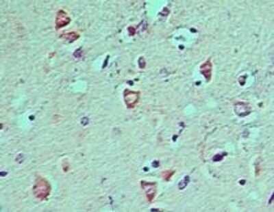 Immunohistochemistry: LC3A Antibody - Azide Free [NBP2-33254] - Staining of Human brain probed with ATG8 antibody at 5 ug/ml. Image from the standard format of this antibody.