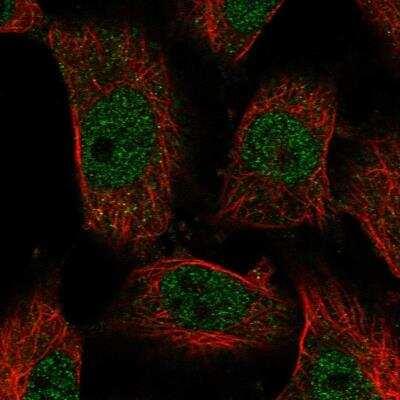 Immunocytochemistry/Immunofluorescence: LCAT Antibody [NBP2-76537] - Staining of human cell line U-251 MG shows localization to nucleoplasm. Antibody staining is shown in green.