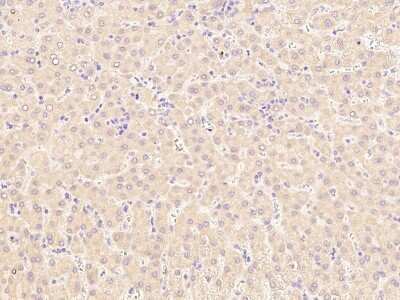 Immunohistochemistry-Paraffin: LCAT Antibody [NBP3-00108] - Staining of human LCAT in human liver with rabbit polyclonal antibody at 1:1000 dilution.