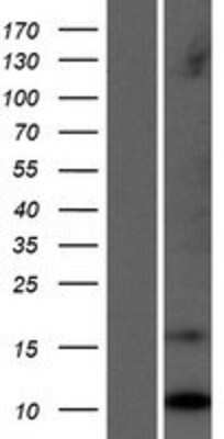 Western Blot: LCE1C Overexpression Lysate (Adult Normal) [NBP2-04976] Left-Empty vector transfected control cell lysate (HEK293 cell lysate); Right -Over-expression Lysate for LCE1C.