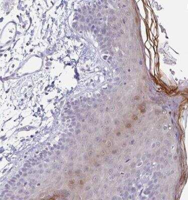 Immunohistochemistry-Paraffin: LCE6A Antibody [NBP1-94116] - Staining of human skin shows moderate cytoplasmic and nuclear positivity in keratinocytes/stratum corneum.