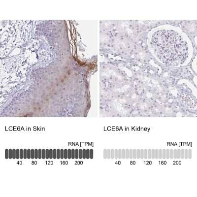 <b>Orthogonal Strategies Validation. </b>Immunohistochemistry-Paraffin: LCE6A Antibody [NBP1-94116] - Staining in human skin and kidney tissues using anti-LCE6A antibody. Corresponding LCE6A RNA-seq data are presented for the same tissues.